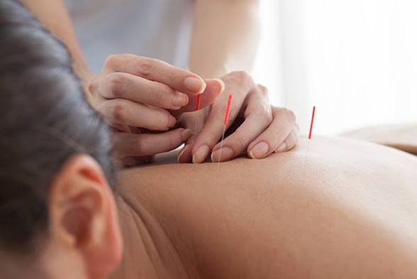 Facial Rejuvenation & Cosmetic Acupuncture: The Natural Approach to Vibrant Skin and Inner Harmony